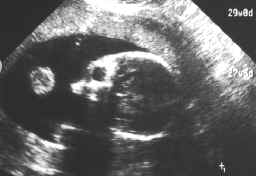 fetus-29-10-98.jpg (88503 bytes)